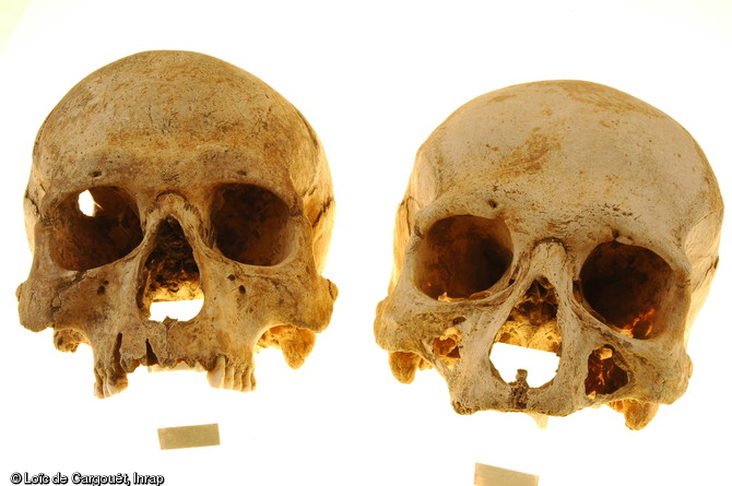 L'étude ostéologique en laboratoire des crânes de la nécropole mérovingienne de Ligny-le-Châtel (Yonne) fouillée en 2005.