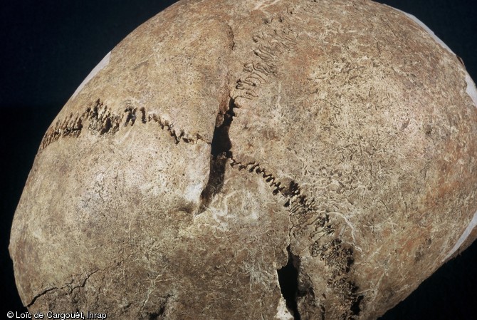 L'étude ostéologique et constatations anthropologiques sur les crânes de la nécropole mérovingienne de Ligny-le-Châtel (Yonne) fouillée en 2005.