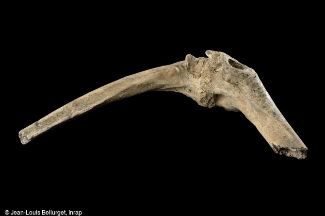 Coude droit, IXe-Xe siècle, découvert dans le cimetière médiéval de Villemomble (Seine-Saint-Denis). Après une luxation du coude, un cal osseux s'est formé sur ces os à cause d'une absence de soin. 