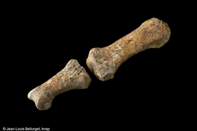 Phalanges d'un doigt de pestiféré, victime de la peste noire de 1348, exhumé à Bondy (Seine-Saint-Denis). 