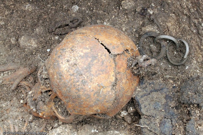 Détail du crâne d'un enfant âgé de 2 ans et demi d'après les mensurations des os, surmonté d'un ensemble de bracelets en schiste et en bronze, dans une sépulture du cimetière d'enfants de l'âge du Fer  à Jort (Calvados) 