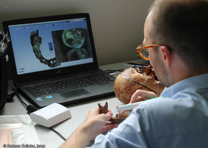 Réalisation d'un scanner surfacique de la mandibule d'Anne d'Alègre, comtesse de Laval,  par l'équipe d'odontologie du CAGT (UMR 5288) et CHU Rangueil de Toulouse. Le squelette a été découvert à Laval (Mayenne), en 1988. 