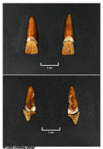 Détail des prothèses dentaires découvertes dans une des deux sépultures du XVIIIe siècle dans l'ancienne église Saint-Genès à Clermont-Ferrand (Puy-de-Dôme).
