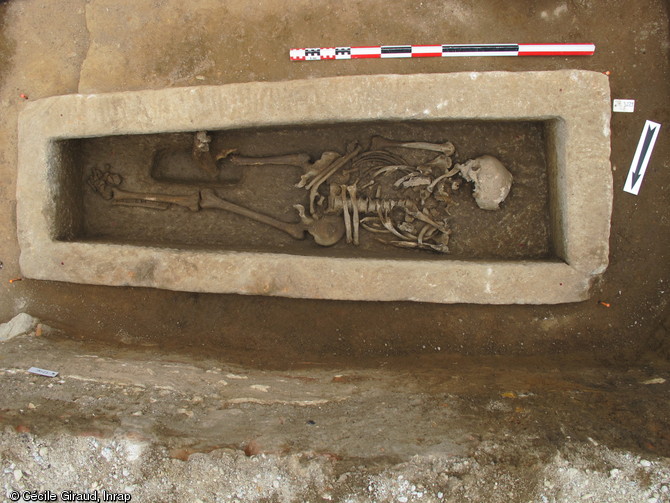 Sépulture en sarcophage présentant une importante pathologie au niveau du genou, collégiale Saint-Martin de Brive (Corrèze), 2012.Le fond de la cuve a été retaillée spécialement afin d'accueillir le genou soudé du défunt.